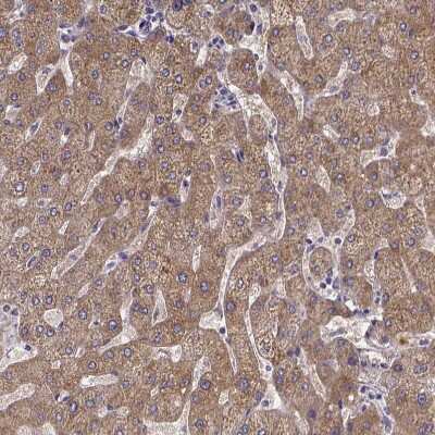 Immunohistochemistry-Paraffin: Phenylalanine Hydroxylase Antibody [NBP1-80917]