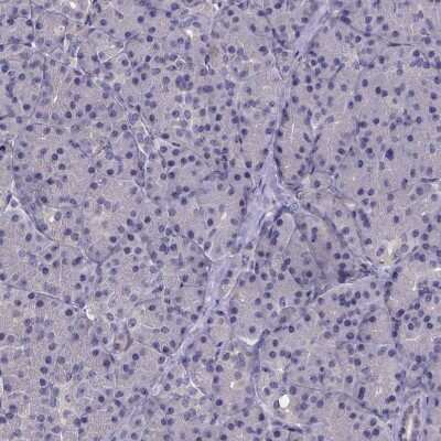 Immunohistochemistry-Paraffin: Phenylalanine Hydroxylase Antibody [NBP1-80917]