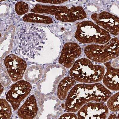 Immunohistochemistry-Paraffin: Phenylalanine Hydroxylase Antibody [NBP2-48615]