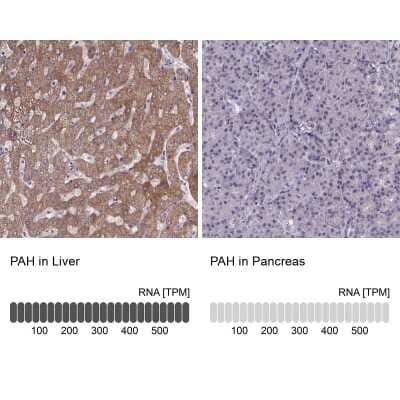 Immunohistochemistry-Paraffin: Phenylalanine Hydroxylase Antibody [NBP2-48615]