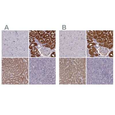 Immunohistochemistry-Paraffin: Phenylalanine Hydroxylase Antibody [NBP2-48615]