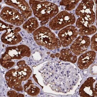 Immunohistochemistry-Paraffin: Phenylalanine Hydroxylase Antibody [NBP2-48615]