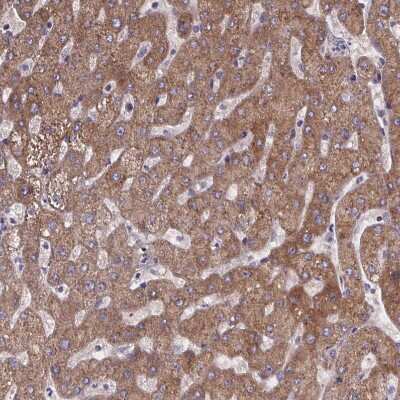 Immunohistochemistry-Paraffin: Phenylalanine Hydroxylase Antibody [NBP2-48615]