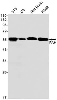 Western Blot: Phenylalanine Hydroxylase Antibody (S06-3H4) [NBP3-19516]