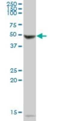 Western Blot: Phenylalanine Hydroxylase Antibody [H00005053-B01P]