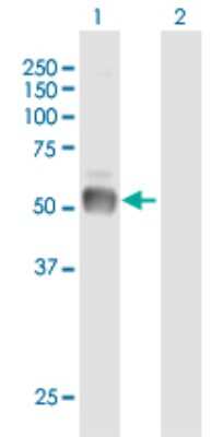 Western Blot: Phenylalanine Hydroxylase Antibody [H00005053-B01P]