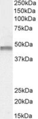 Western Blot: Phenylalanine Hydroxylase Antibody [NBP1-52084]