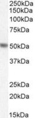 Western Blot: Phenylalanine Hydroxylase Antibody [NBP1-52084]