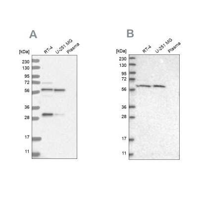 Western Blot: Phenylalanine Hydroxylase Antibody [NBP1-80917]