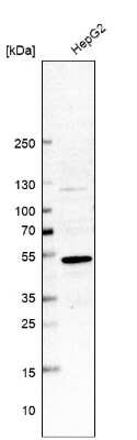 Western Blot: Phenylalanine Hydroxylase Antibody [NBP2-48615]