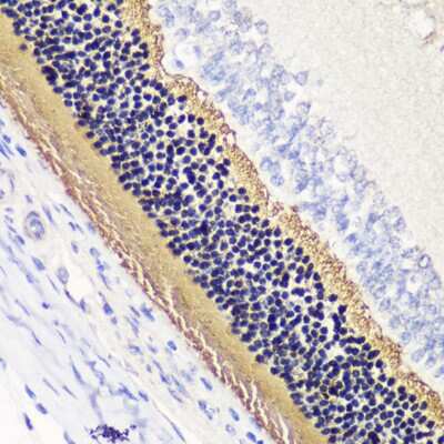 Immunohistochemistry-Paraffin: Phosducin Antibody - BSA Free [NBP2-93747]