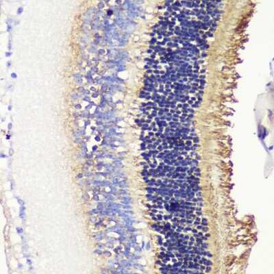 Immunohistochemistry-Paraffin: Phosducin Antibody - BSA Free [NBP2-94660]