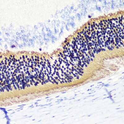 Immunohistochemistry-Paraffin: Phosducin Antibody - BSA Free [NBP2-94660]