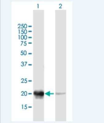 Western Blot: Phosducin Antibody [H00005132-B01P-50ug]