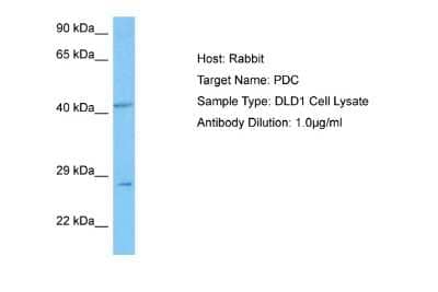 Western Blot: Phosducin Antibody [NBP2-85471]