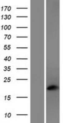 Western Blot: Phosducin Overexpression Lysate [NBP2-06421]