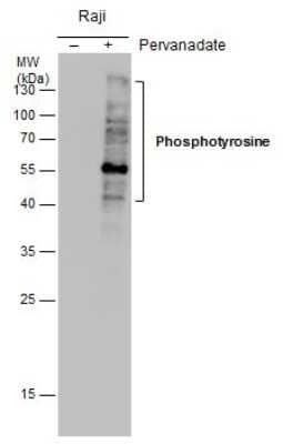 Western Blot: Phospho-Tyrosine Antibody (21) [NBP2-42911]