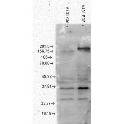 Western Blot: Phospho-Tyrosine Antibody (G104) [NBP1-47562]