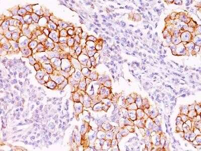 Immunohistochemistry-Paraffin: Phospho-Tyrosine Antibody (PY20) - Azide and BSA Free [NBP2-33166]