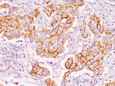 Immunohistochemistry-Paraffin: Phospho-Tyrosine Antibody (PY793) - Azide and BSA Free [NBP2-34730]