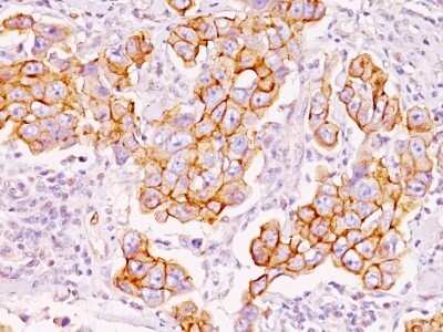 Immunohistochemistry-Paraffin: Phospho-Tyrosine Antibody (PY793) [NBP2-45213]