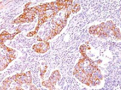 Immunohistochemistry-Paraffin: Phospho-Tyrosine Antibody (SPM102) [NBP2-32990]