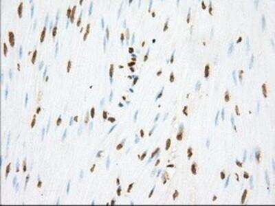 Immunohistochemistry-Paraffin: Phosphodiesterase 4A/PDE4A Antibody (OTI1C8) [NBP2-02559]