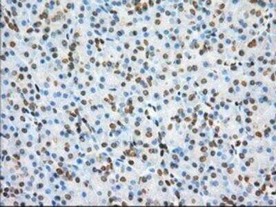 Immunohistochemistry-Paraffin: Phosphodiesterase 4A/PDE4A Antibody (OTI1C8) [NBP2-02559]