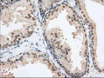 Immunohistochemistry-Paraffin: Phosphodiesterase 4A/PDE4A Antibody (OTI1C8) [NBP2-02559]