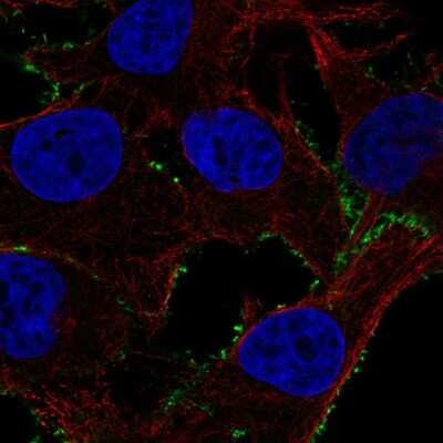 Immunocytochemistry/ Immunofluorescence: Phosphodiesterase 4A/PDE4A Antibody [NBP2-55923]