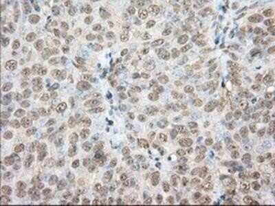 Immunohistochemistry: Phosphodiesterase 4A/PDE4A Antibody (OTI1C8) - Azide and BSA Free [NBP2-73376]