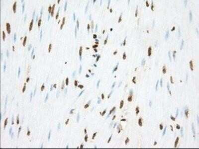 Immunohistochemistry: Phosphodiesterase 4A/PDE4A Antibody (OTI1C8) - Azide and BSA Free [NBP2-73376]