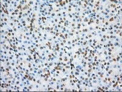 Immunohistochemistry: Phosphodiesterase 4A/PDE4A Antibody (OTI1C8) - Azide and BSA Free [NBP2-73376]