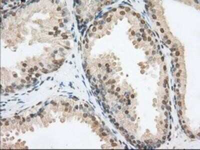 Immunohistochemistry: Phosphodiesterase 4A/PDE4A Antibody (OTI1C8) - Azide and BSA Free [NBP2-73376]