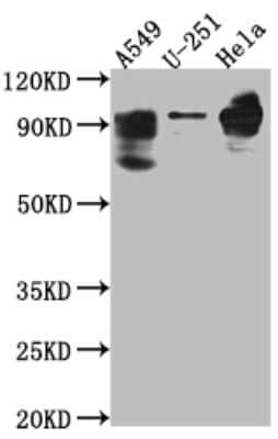 Western Blot: Phosphodiesterase 4D Antibody (4D4) [NBP3-15210]