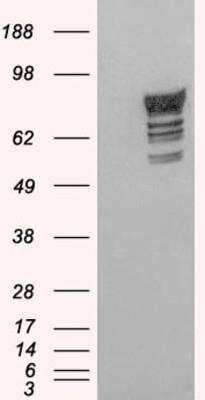 Western Blot: Phosphodiesterase 4D Antibody [NB100-2462]