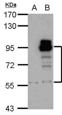 Western Blot: Phosphodiesterase 4D Antibody [NBP1-31131]