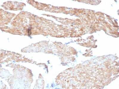 Immunohistochemistry-Paraffin: Phosphoglucomutase 5 Antibody (14F8/F8) - Azide and BSA Free [NBP3-08656]