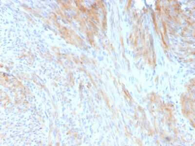 Immunohistochemistry-Paraffin: Phosphoglucomutase 5 Antibody (14F8/F8) - Azide and BSA Free [NBP3-08656]
