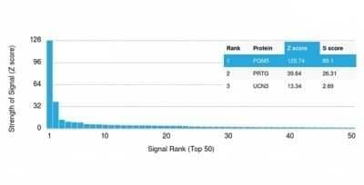 Protein Array: Phosphoglucomutase 5 Antibody (PGM5/3552) - Azide and BSA Free [NBP3-14132]