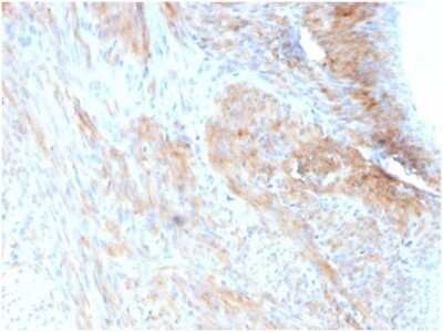 Immunohistochemistry-Paraffin: Phosphoglucomutase 5 Antibody (PGM5/3552) [NBP3-13996]