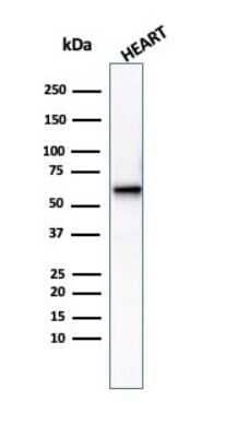 Western Blot: Phosphoglucomutase 5 Antibody (PGM5/3552) [NBP3-13996]