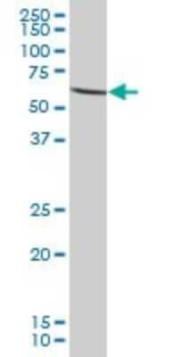 Western Blot: Phosphoglucomutase 5 Antibody [H00005239-B01P]