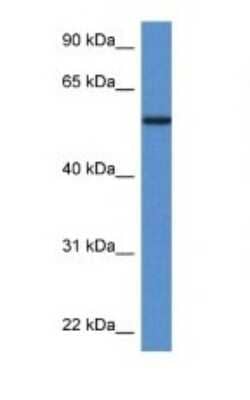 Western Blot: Phosphoglucomutase 5 Antibody [NBP1-74091]