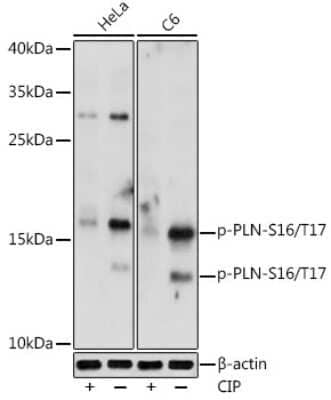 Western Blot: Phospholamban [p Ser16, p Thr17] AntibodyAzide and BSA Free [NBP3-16904]