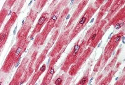 Immunohistochemistry-Paraffin: Phospholamban Antibody [NBP1-49852]
