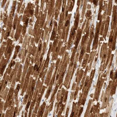 Immunohistochemistry-Paraffin: Phospholamban Antibody [NBP1-85543]