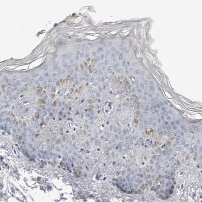 Immunohistochemistry-Paraffin: Phospholamban Antibody [NBP1-85543]