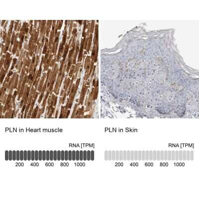 Immunohistochemistry-Paraffin: Phospholamban Antibody [NBP1-85543]