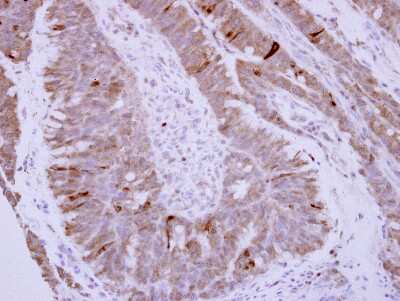 Immunohistochemistry-Paraffin: Phospholamban Antibody [NBP2-19807]